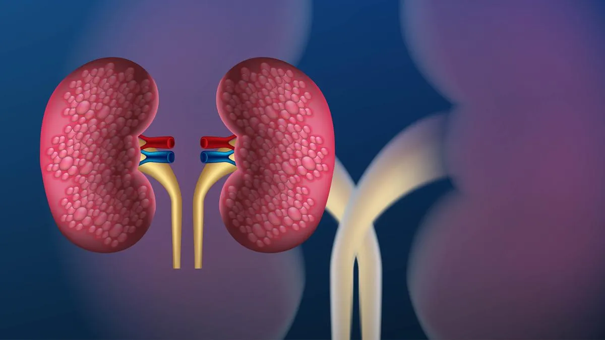 A kidney sale that led to a CB-CID probe in Tamil Nadu