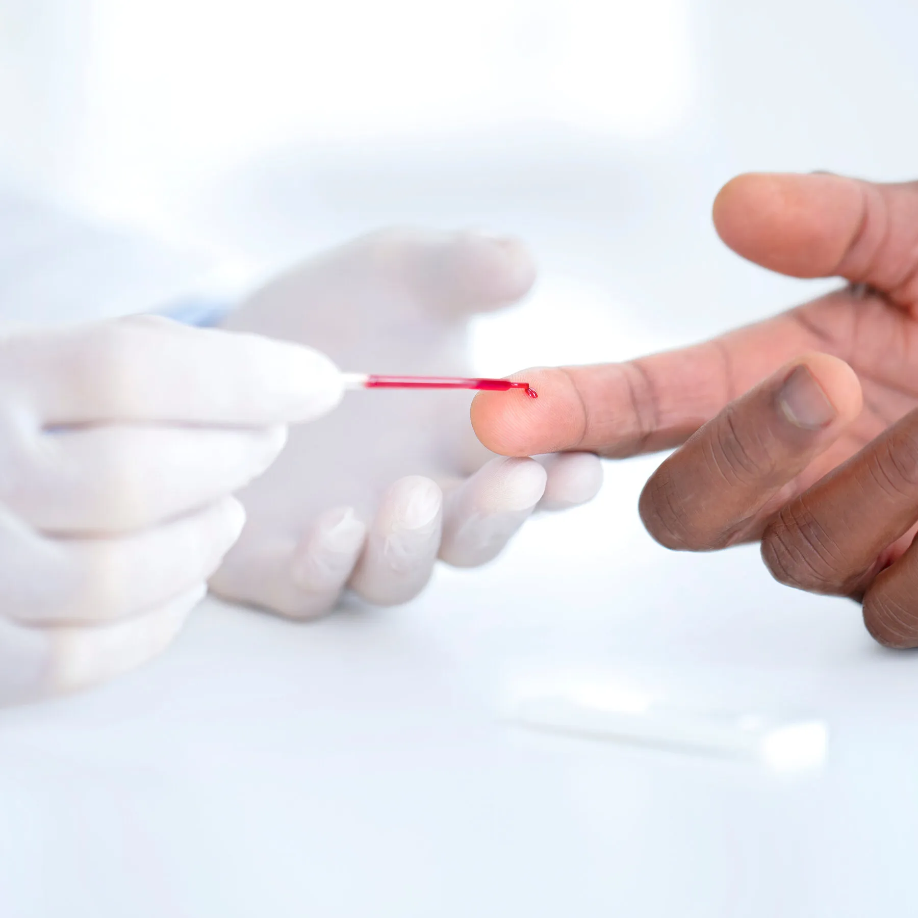 Earlier Cholesterol Testing Can Reduce Heart Attacks and Strokes, New Guideline Says